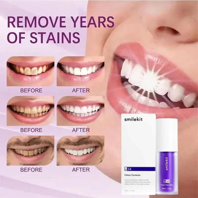 SMILEKIT V34 Purple Whitening Toothpaste Remove Smoke Stain Remove Stains Reduce Yellowing Care for Teeth Gums Fresh Breath